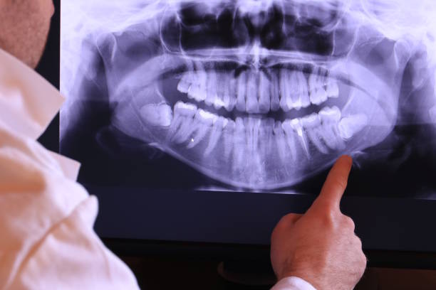 Best Emergency Treatment for Toothache in Mona, UT