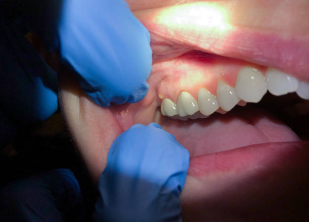 Best Pediatric Emergency Dentist in Mona, UT